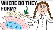 Why and where do senescent cells form?