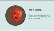 Cellulitis: Causes, Symptoms, Diagnosis, and Treatment | Merck Manual Consumer Version Quick Facts