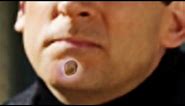 World's Largest Chin Zits, Chin Blackheads and Chin Pimples (Photoshop Thumbnail)