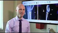 Broken Wrists: Fracture Types, Treatment Options, & Recovery - Dr. Froelich