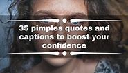 35 pimples quotes and captions to boost your confidence