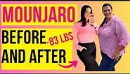 😮SHOCKING -83 LB MOUNJARO WEIGHT LOSS BEFORE AND AFTER // 5 TIPS ZEPBOUND WEIGHT LOSS / BIOPTIMIZERS
