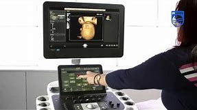 How to Perform a 4D Acquisition on a Philips EPIQ Ultrasound System