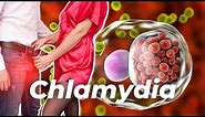 Sneaky Chlamydia | Do You Have It & Not Know It?