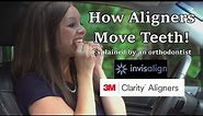 How aligners (like Invisalign) move teeth - Time lapse explained!