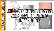 Opportunistic Infections and AIDS-defining illnesses - CD4+ cell count, malignancy, treatment