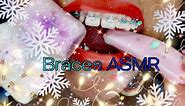 Pink Emoji challenge ASMR. braces
