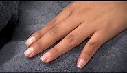 Mayo Clinic Minute - Fingernails are clues to your health