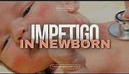 Impetigo, a Dermal Infection in Newborn Babies