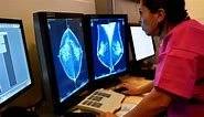 Surge in cancer for those under 50: study