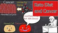Ketogenic Diet for Cancer: Treatment and Prevention