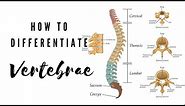 How to differentiate Vertebrae | Viva Voce of Anatomy