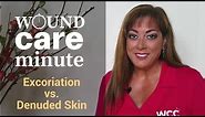 What's the Difference Between Excoriation and Denuded Skin?