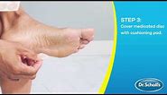 Dr. Scholl's | How To Use CLEAR Away® Wart Remover Plantar for Feet