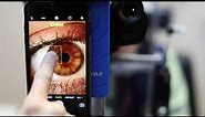 How to use iPhone AE/AF lock for Slit Lamp Photography
