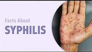 Everything To Know About Syphilis under 2 minutes [Animated video]