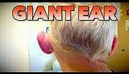 GIANT EAR: Allergic Reaction or Infection? | Dr. Paul
