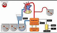 Cardiopulmonary bypass (CPB) circuit