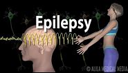 Epilepsy: Types of seizures, Symptoms, Pathophysiology, Causes and Treatments, Animation.