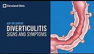 Warning Signs of Diverticulitis | Ask Cleveland Clinic's Expert