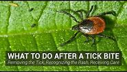What to Do After a Tick Bite - Johns Hopkins Lyme Disease Research Center