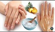 How To Remove Wrinkles From Hands Naturally in 2 Days