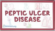 Peptic ulcer disease - causes, symptoms, diagnosis, treatment, pathology