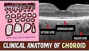 Anatomy Of Choroid | Haller's layer, Sattler's layer, Choriocapillaris and Clinical Nuggets |