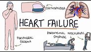Understanding Heart Failure: Visual Explanation for Students