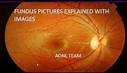 Fundus images explained by an ophthalmologist