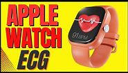 Apple Watch ECG: What you need to know.