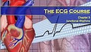 The ECG Course - Junctional Rhythms