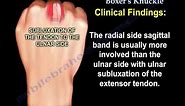 Sagittal Band Injury Boxer's Knuckle - Everything You Need To Know - Dr. Nabil Ebraheim