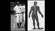 ALS (Lou Gehrig's Disease) - Health Matters