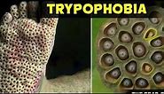Trypophobia, what is it? Treatment. Story of Trypophobia.