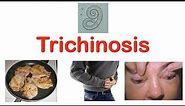 Trichinosis (Pork Parasite) | Pathophysiology, Signs & Symptoms, Diagnosis, Treatment