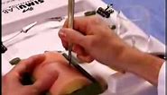 Using a #15 blade scalpel: Proper Technique Example 2