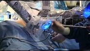 Minimally Invasive Robotic Surgery with the da Vinci Surgical System | UCLA Urology