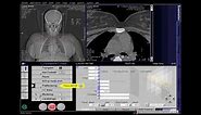 CT Carotid Angio Full Work Process (SIEMENS) in syngo acquisition workplace