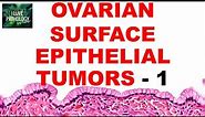 OVARIAN TUMORS - Part 2 : SEROUS AND MUCINOUS TUMORS- Etiopathogenesis and morphology