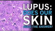Lupus | Does our skin hold the answer?
