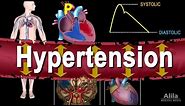 Hypertension - High Blood Pressure, Animation