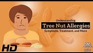 Tree Nut Allergies 101: A Comprehensive Guide to Your Health