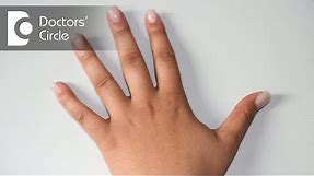 Dark knuckles : Causes & Tips to lighten them - Dr. Rasya Dixit