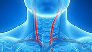 Carotid Artery Disease and Stroke: Prevention and Treatment | Q&A - Johns Hopkins Medicine