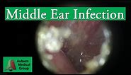 Ear Infection Pain Treatment in an Adult | Auburn Medical Group