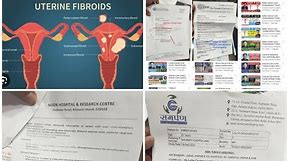UTERINE FIBROID LARGE 8 CM CURED & DISSOLVED WITHOUT SURGERY BY DR ARPITCHOPRAJAIN MODERNHOMEOPATHY