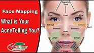 What is Your Acne Telling You? : Face Mapping - VitaLife Show Ep 243