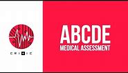 ABCDE assessment - a quick overview