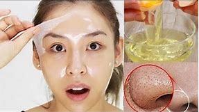 Egg White Face Mask | Diy Face Mask For Loose Skin, Skin Tightening & Open Pores 🌿